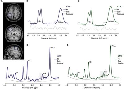 Motor Cortex Excitation/Inhibition Imbalance in Young Adults With Autism Spectrum Disorder: A MRS-TMS Approach